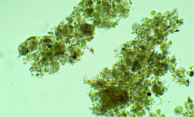 Osad czynny pod mikroskopem (powiększenie x10)